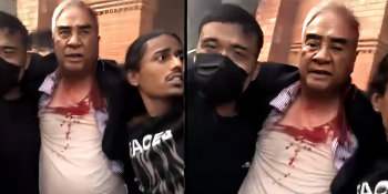 शेर बहादुर देउवा दम्पतीमाथि कुटपिट, घरमा आगजनी