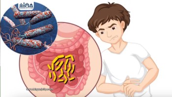 वीरगन्जपछि पोखरियामा पनि हैजाको संक्रमण पुष्टि